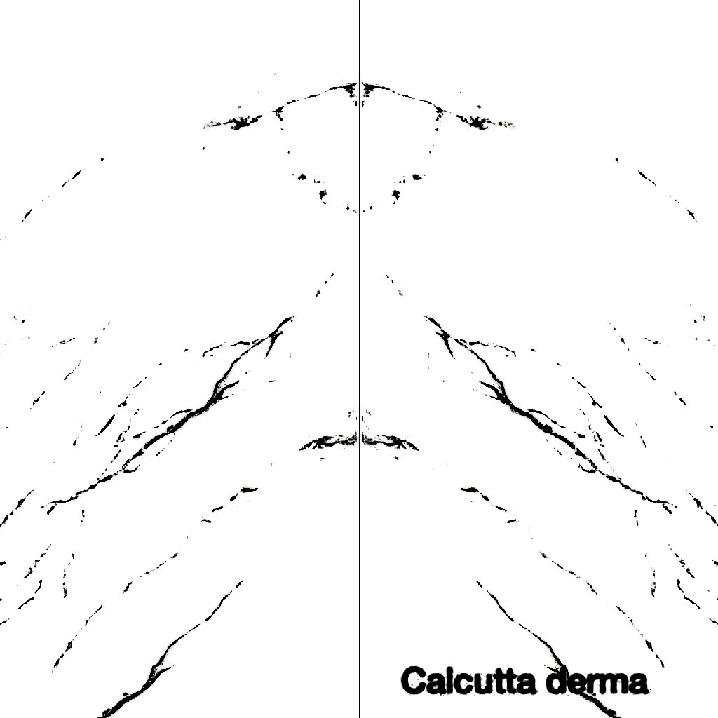 2342428998-Calacatta_Derma